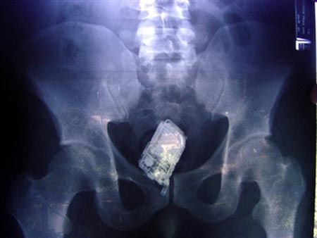 xray phone xray phone